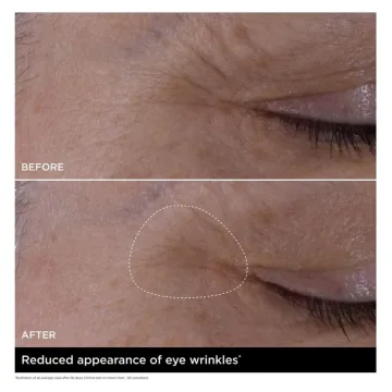 Double Serum Eye 20 ml