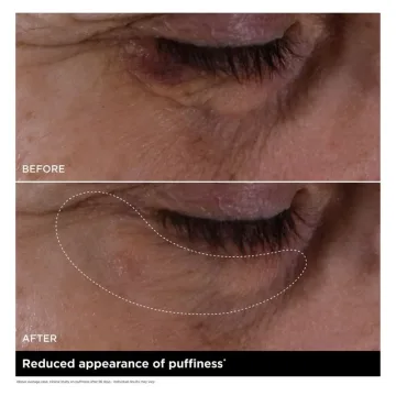 Double Serum Eye 20 ml