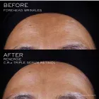 Renergie C.r.x. Triple Serum Retinol 20 ml